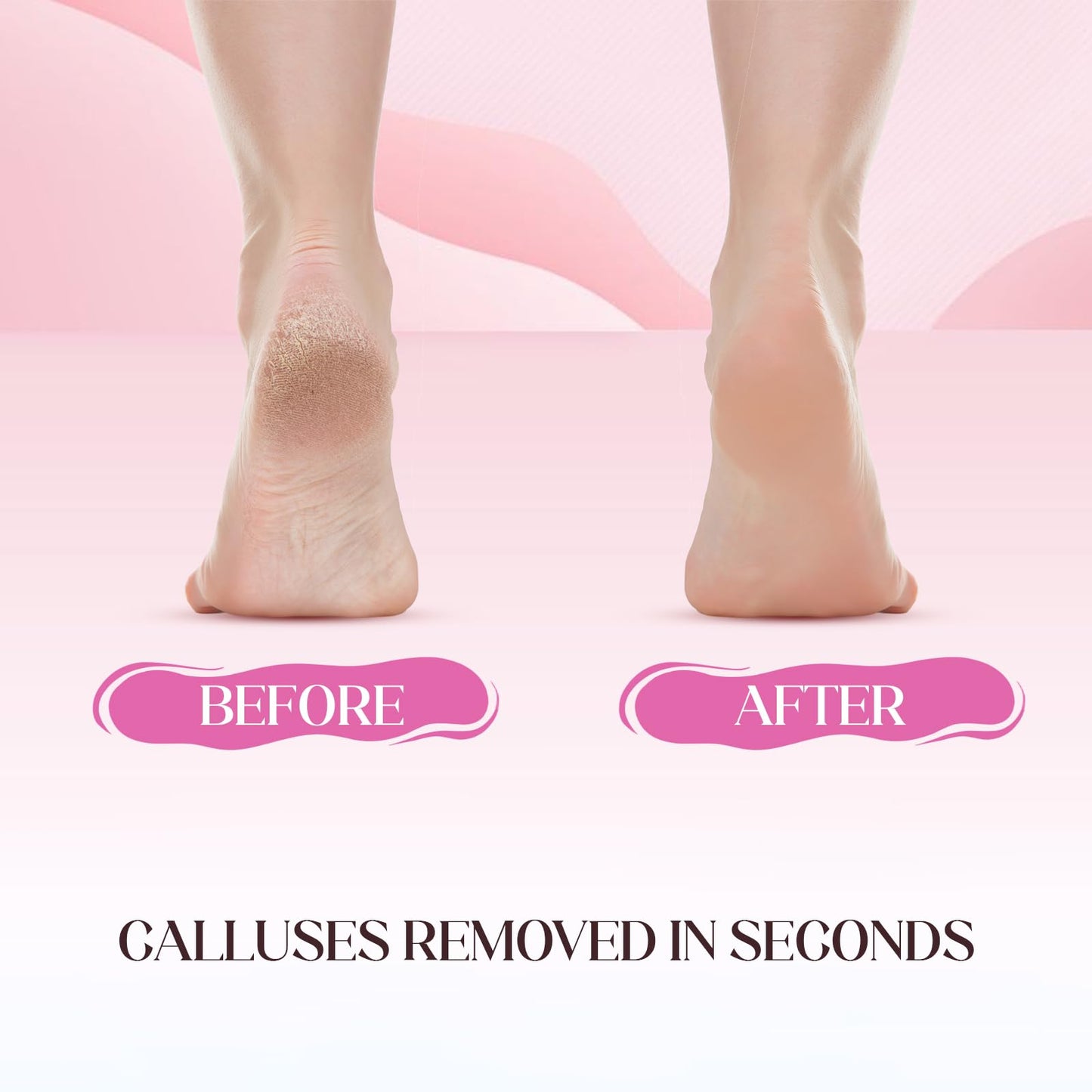 BTTEUYE Foot Callus Remover kit - Pedicure Exfoliation Tool - Dry Dead Skin Scrubber - Pumice Stone for Feet - Pumice Stone,Foot Spa Tablets fot Pedicure - Health Feet Pedicure Care (Rose)