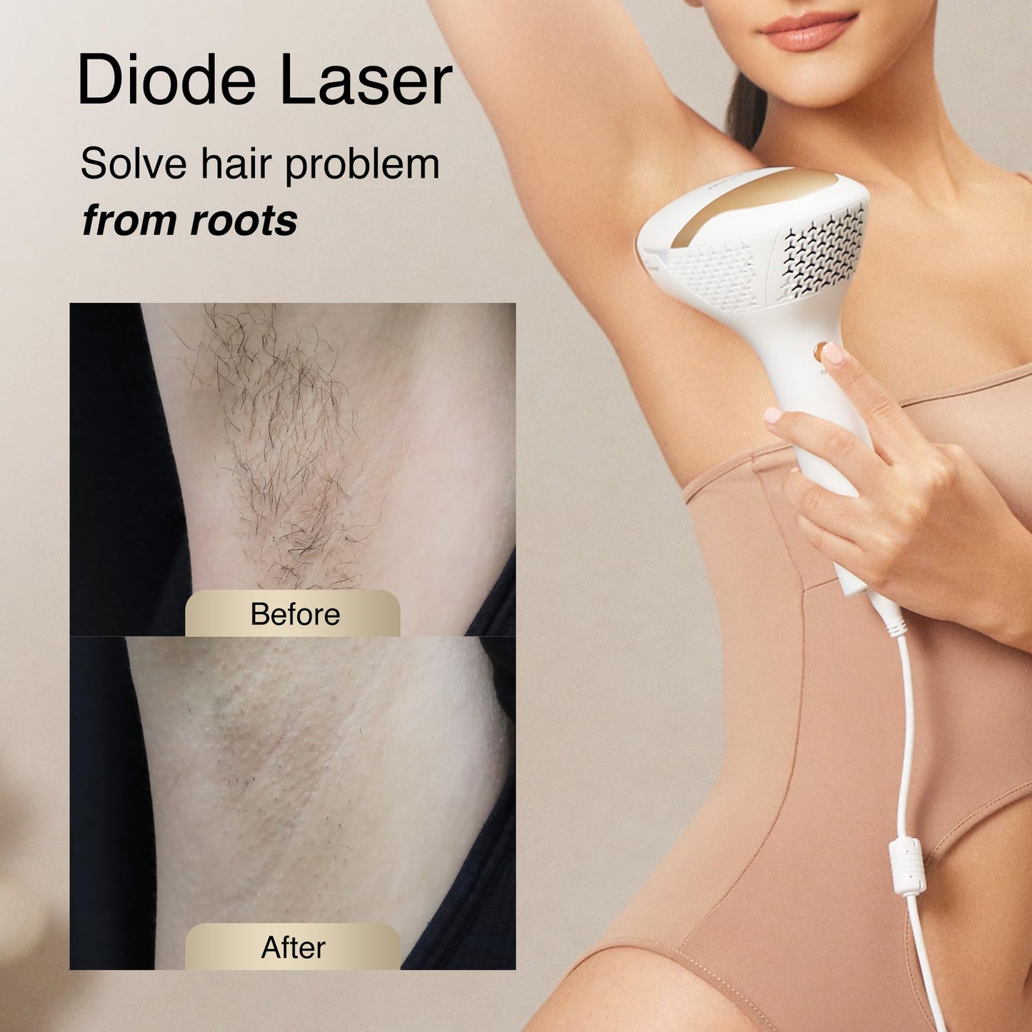 DermRays V4S Diode Laser Hair Removal with Gel